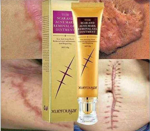 Crème Anti Cicatrice & Vergetures