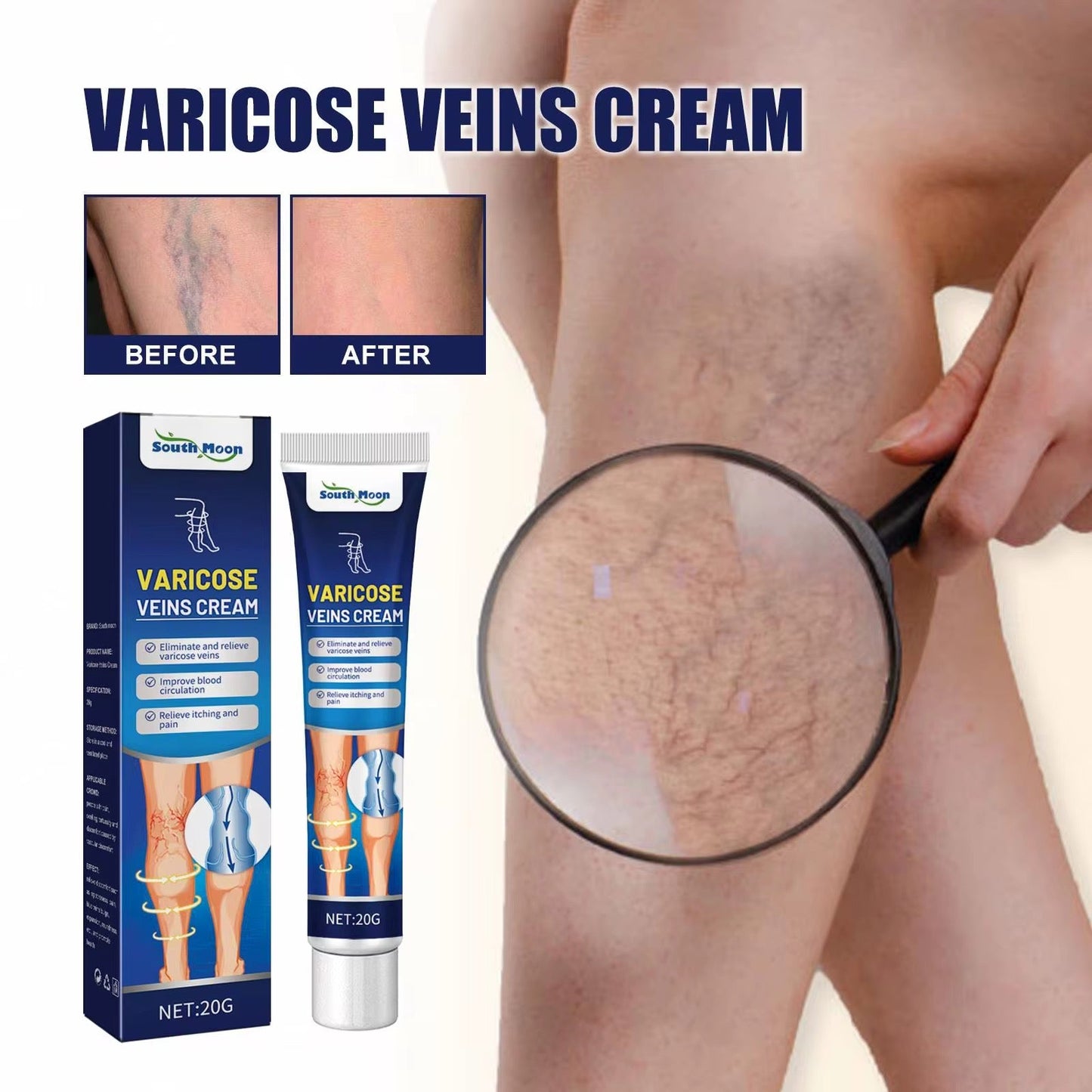 Crème pour traitement définitif des varices