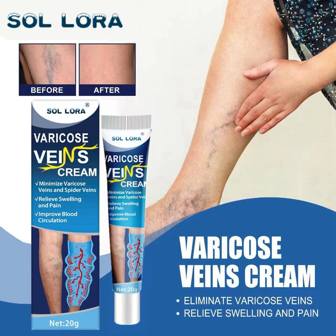 Crème pour traitement définitif des varices