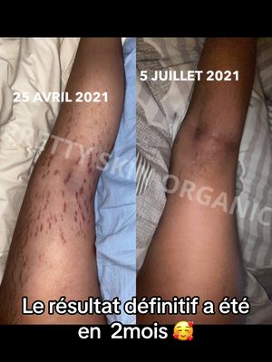 Huile anti vergetures