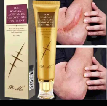 Crème Anti Cicatrice & Vergetures