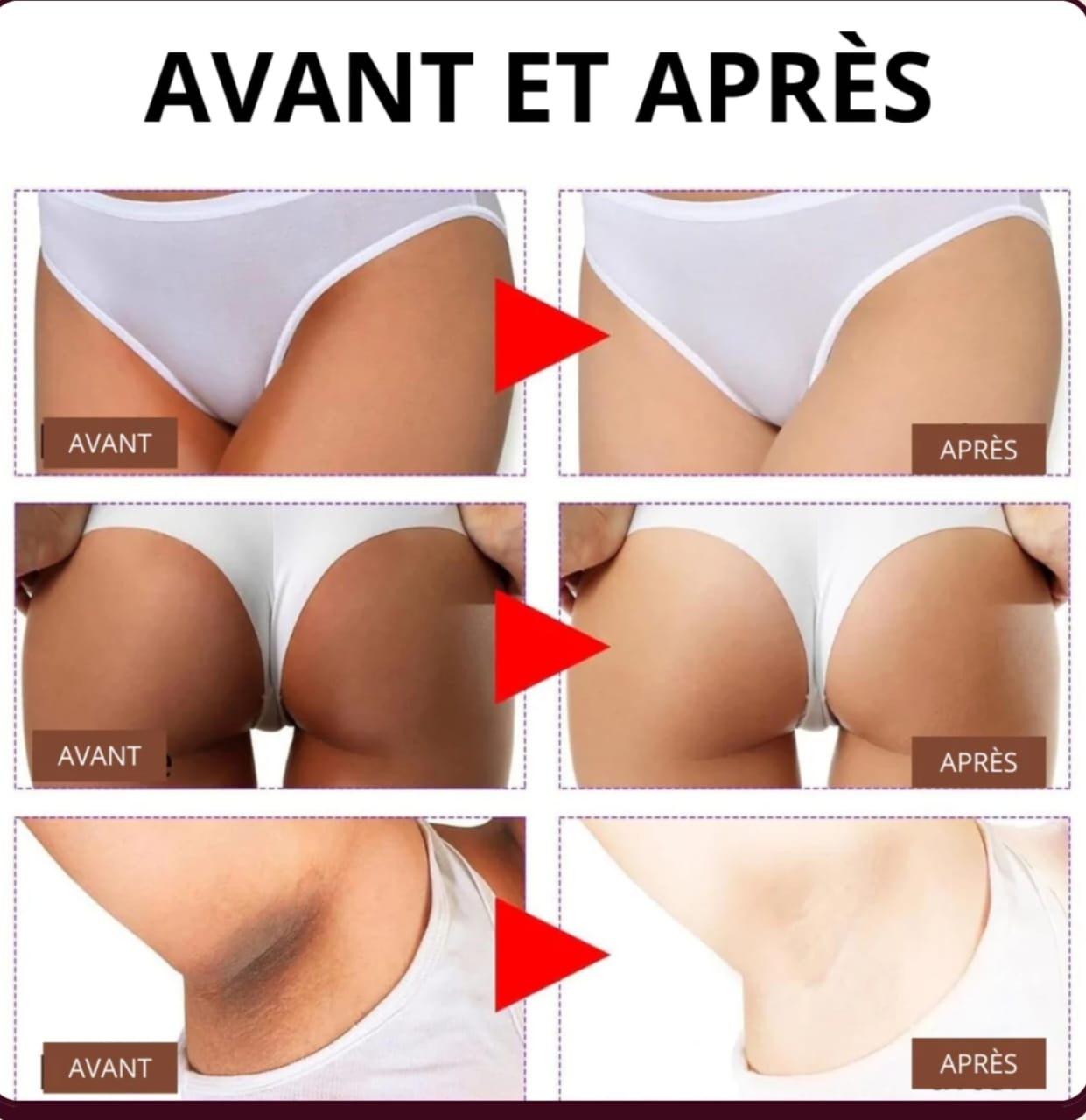 Crème anti fards et mamies & quintos noirs