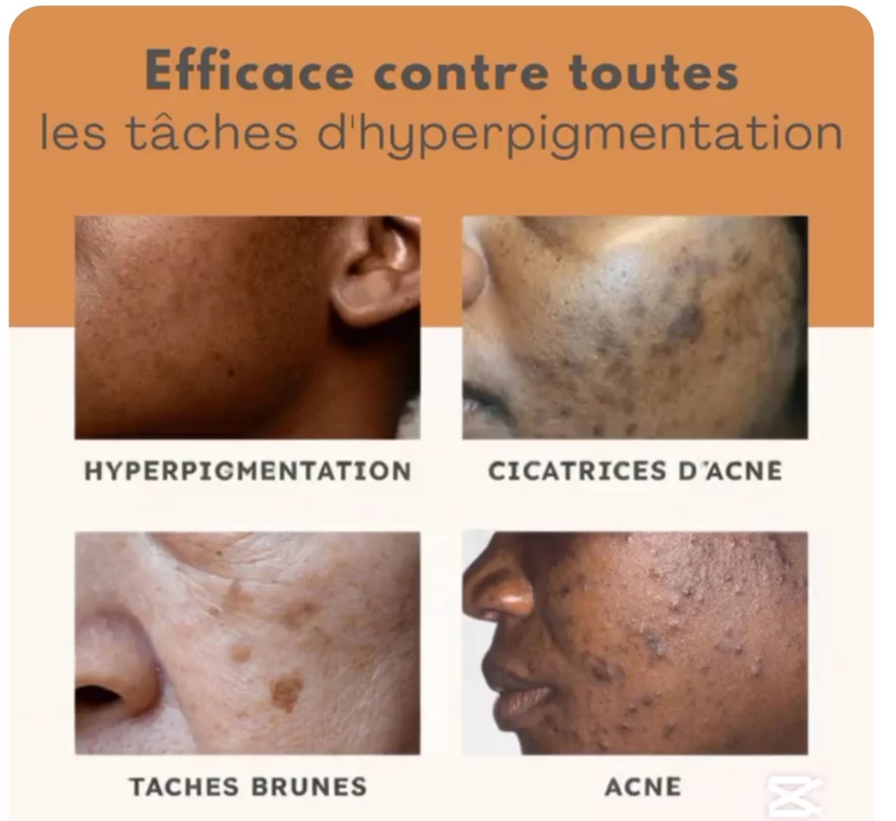 Crème anti fards et mamies & quintos noirs