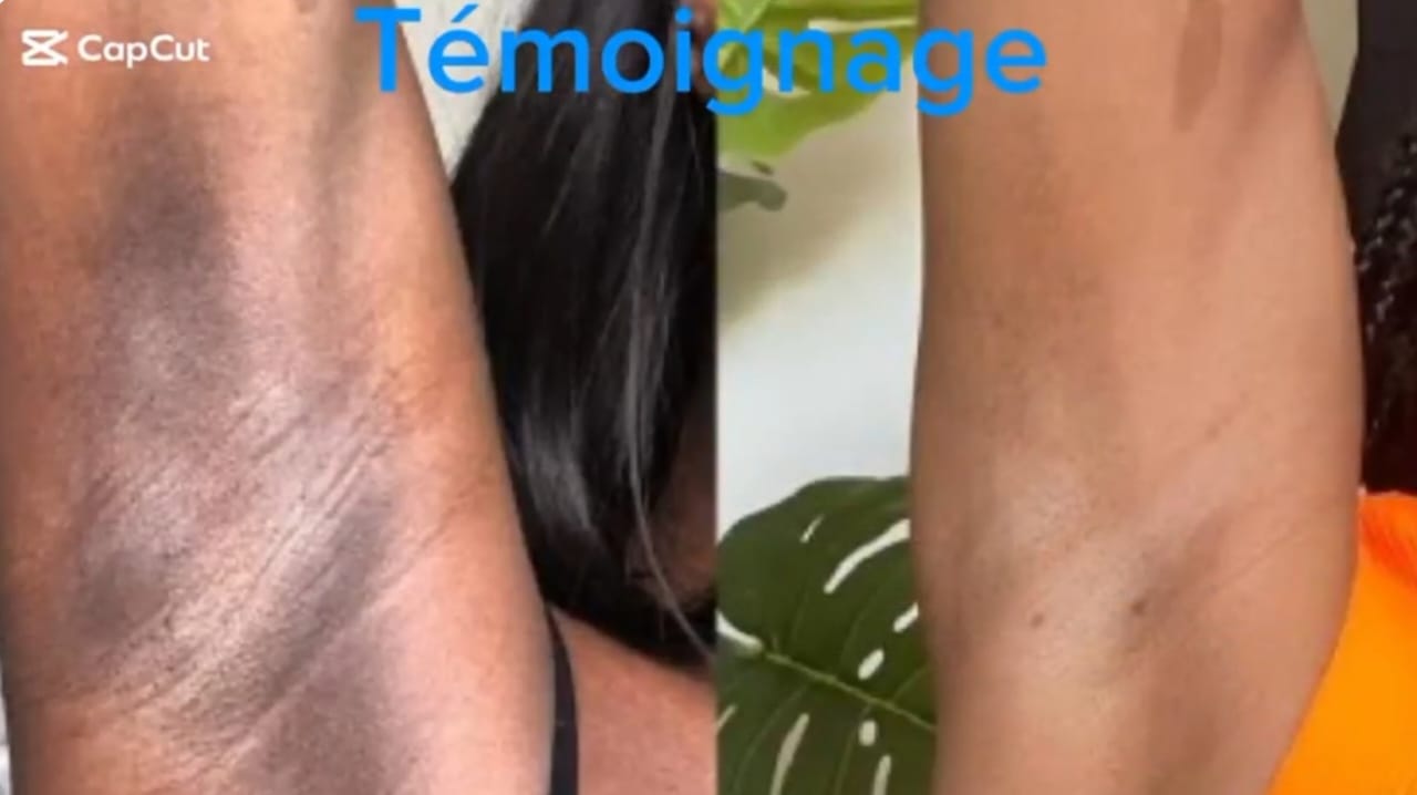 Crème anti fards et mamies & quintos noirs