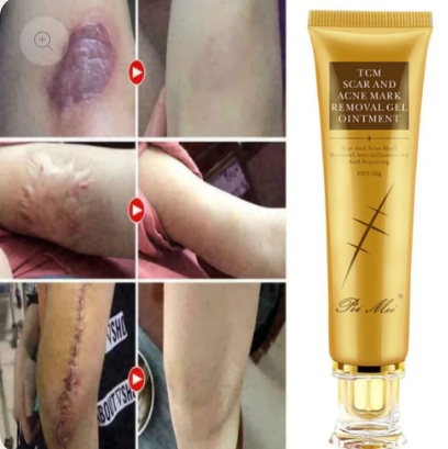 Crème Anti Cicatrice & Vergetures